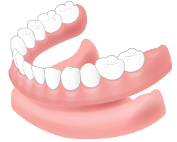 総義歯（総入れ歯）